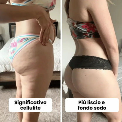 VacuGlow - Pelle tonica e levigata - in 2 Settimane